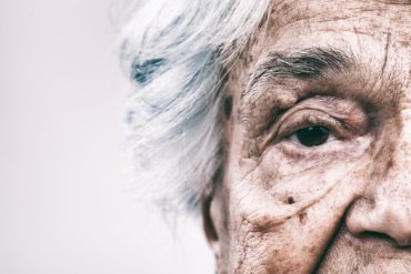 Senior Woman Dementia